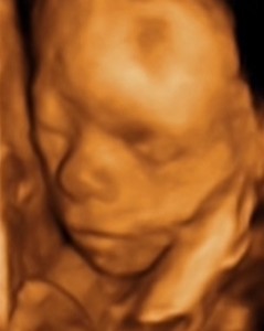 ultrazvuk-foto.jpg